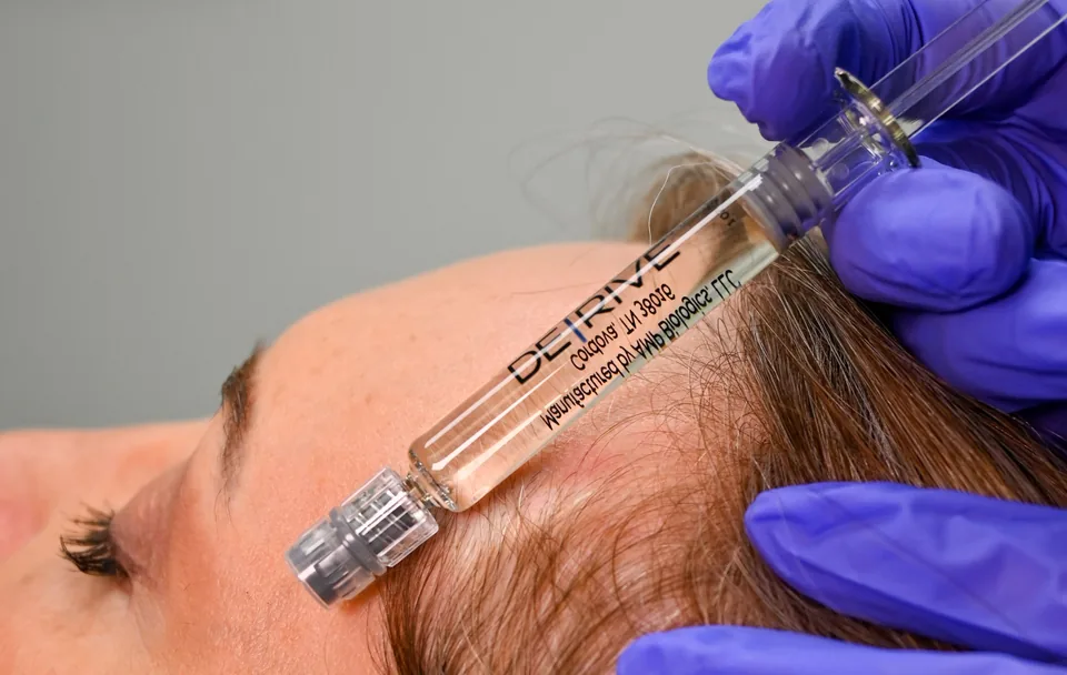 A DERIVE syringe held at a client’s hairline