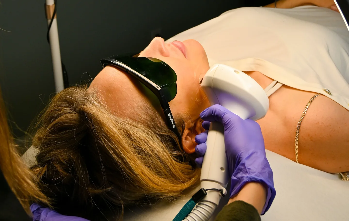 The IPL handpiece on a client’s neck, protective eyewear on