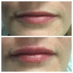 photo of lips