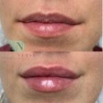 picture of lips