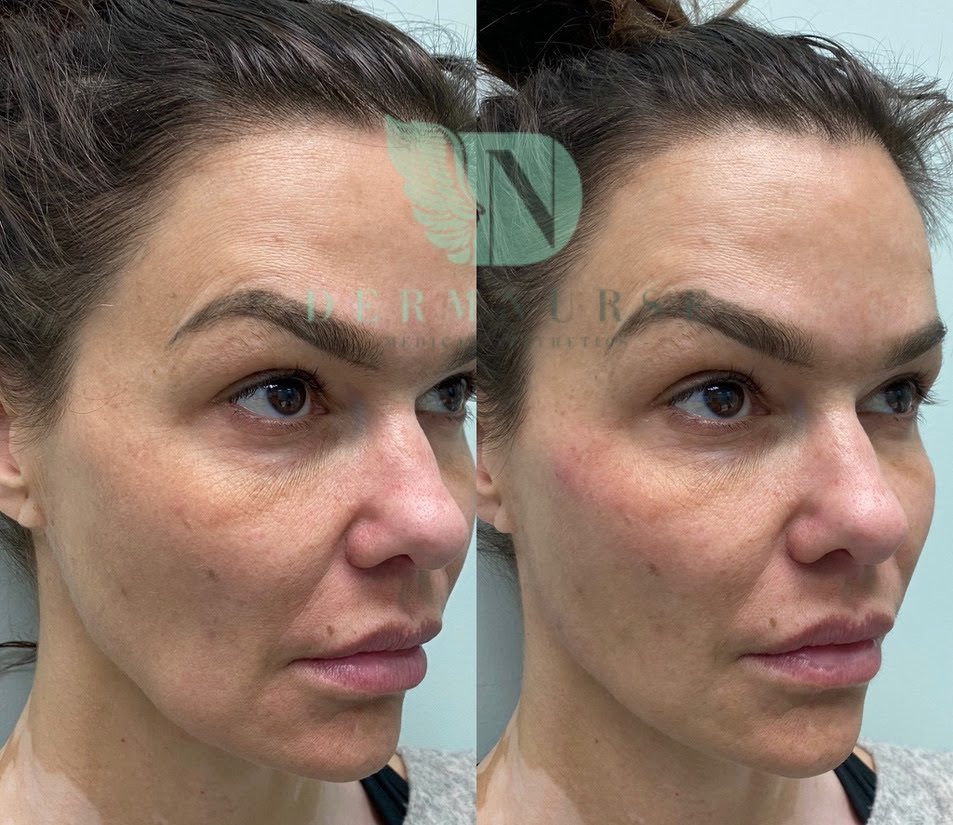 A before and after image of a womens face