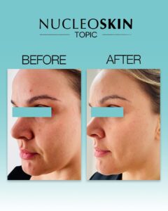 Nucleoskin